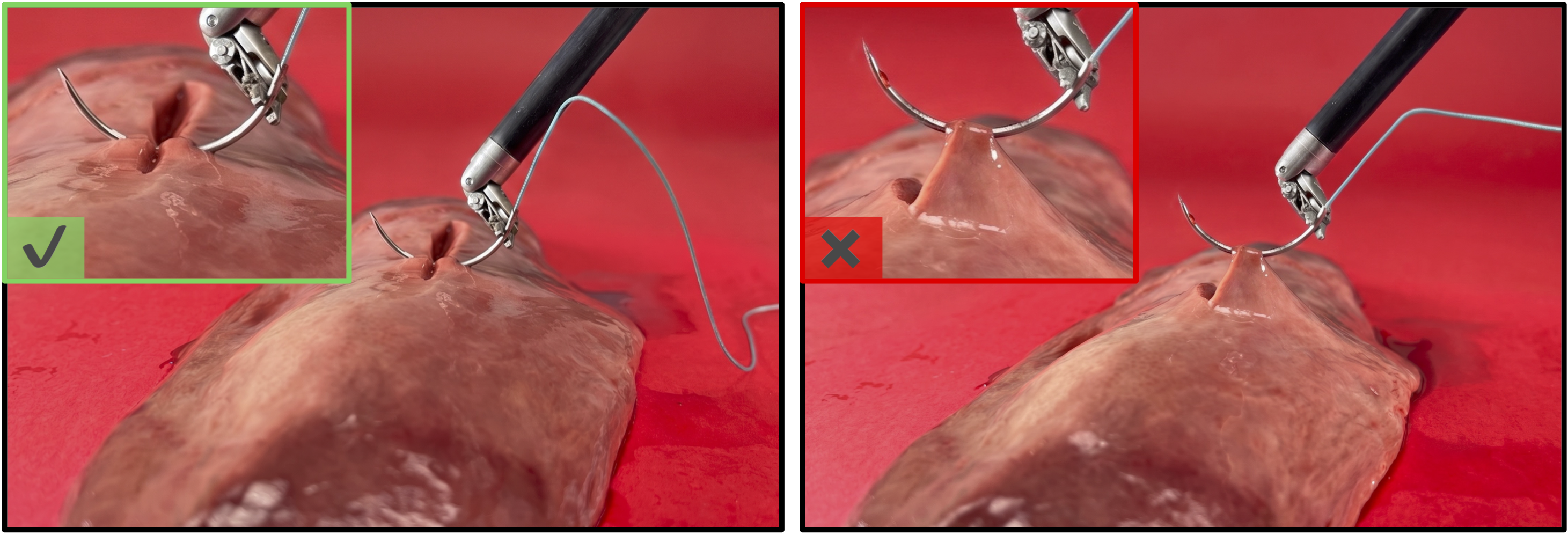 Adversarial attacks on surgical robotic tasks showing successful vs failed grasping